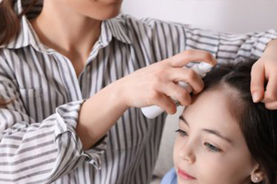 PEDICULOSIS